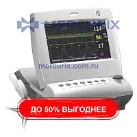 Фетальный монитор ЧСС F6