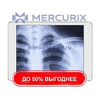 Система сбора данных для медицинских изображений для радиографии iRay DR