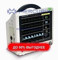 Переносной монитор пациента