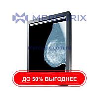 Маммографический монитор GS520 series