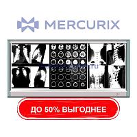 Негатоскоп 3 диапазона GP1003A
