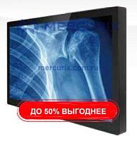 Монитор для медицинских снимков M270TF