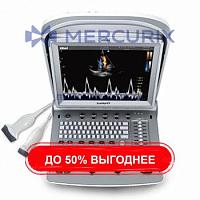 Переносной ультразвуковой сканер SonoRad K9