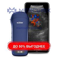Портативный ультразвуковой сканер C10