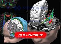 Программное обеспечение для анализа CURRY 9 SBA