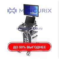 Ультразвуковой сканер на платформе YSB-VIV20
